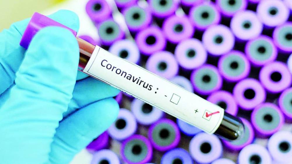 Կորոնավիրուսի վարակման 50 նոր դեպք է գրանցվել. հաստատված դեպքերի թիվը հասավ 532-ի