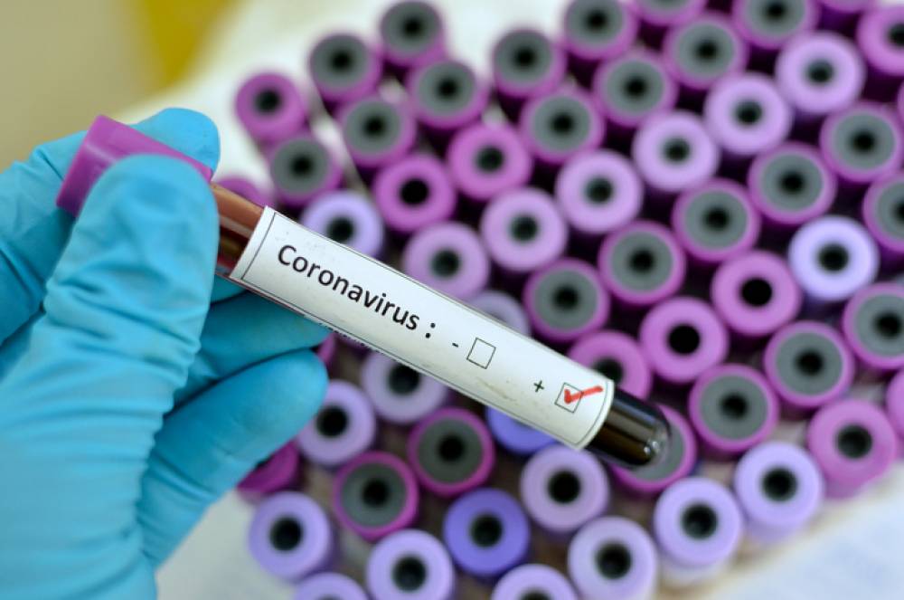 Վրաստանում մեկ օրում գրանցվել է կորոնավիրուսով վարակման 26 նոր դեպք