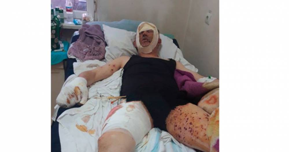 Մատաղիսում ականի պայթյունից վիրավորված ՊԲ փոխգնդապետին տեղափոխել են Ադրբեջան