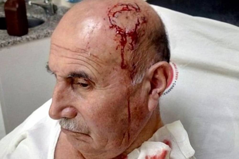 Թուրքիայում 74-ամյա քուրդ տղամարդը դաժան ծեծի է ընթարկվել իր կնոջ հետ քրդերեն խոսելու համար