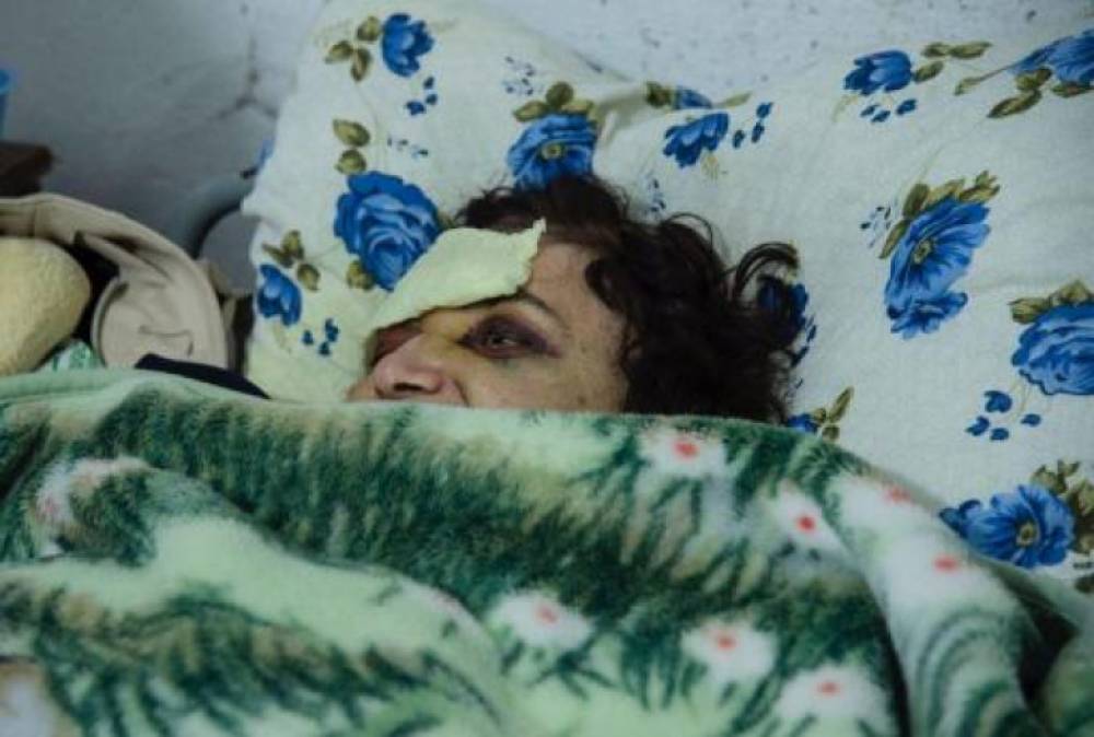 70-ամյա Էլմիրան վիրավորվել է Ասկերանի շրջանի Շոշ գյուղի հրետակոծության հետևանքով