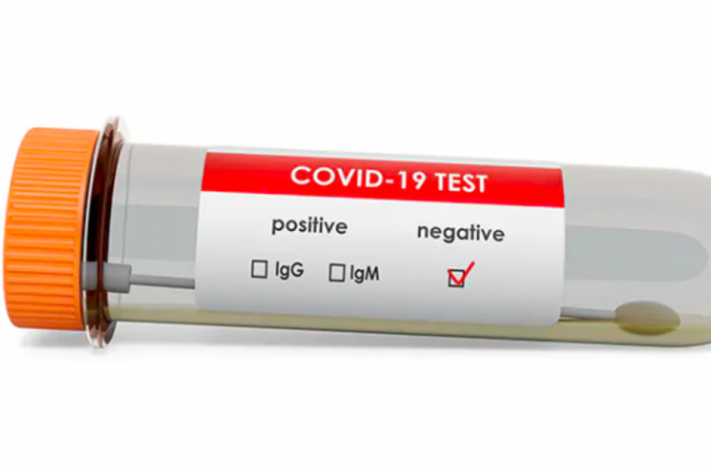 Արցախում այսօր կորոնավիրուսի 14 թեստ է արվել, վարակի նոր դեպք չի գրանցվել