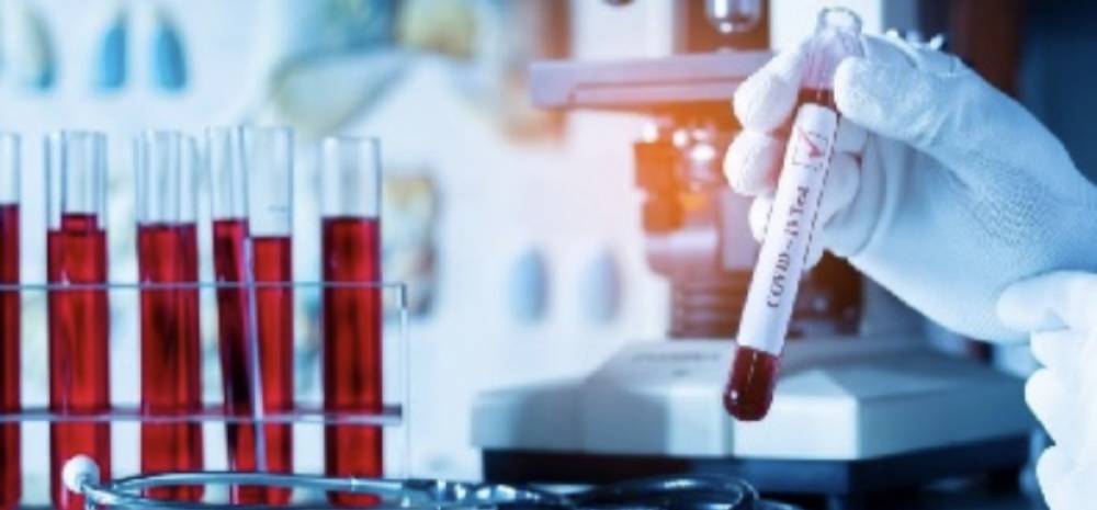 Արցախում կորոնավիրուսային հիվանդության նոր դեպքերը