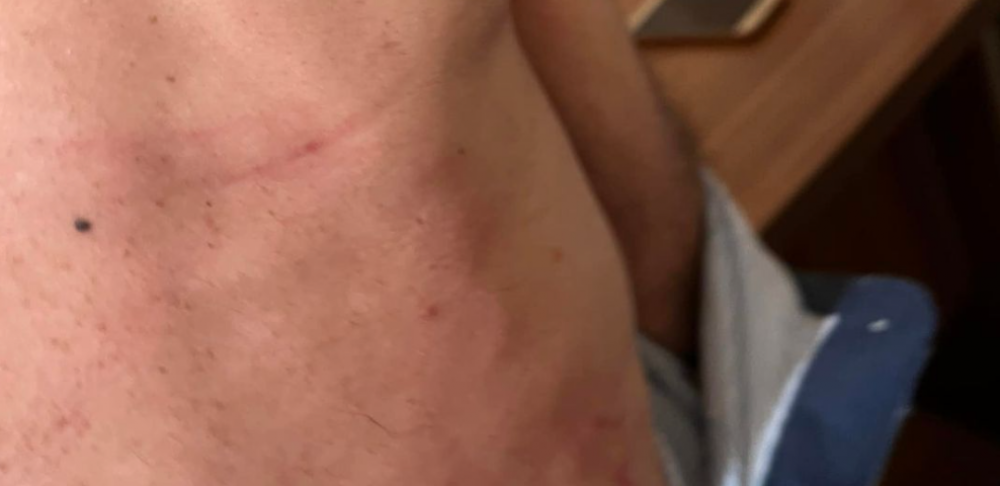 Արաբկիրում ամենաթեթև վնասվածքը բերման ենթարկվածի այս տեսքն ունի. Իրավաբան