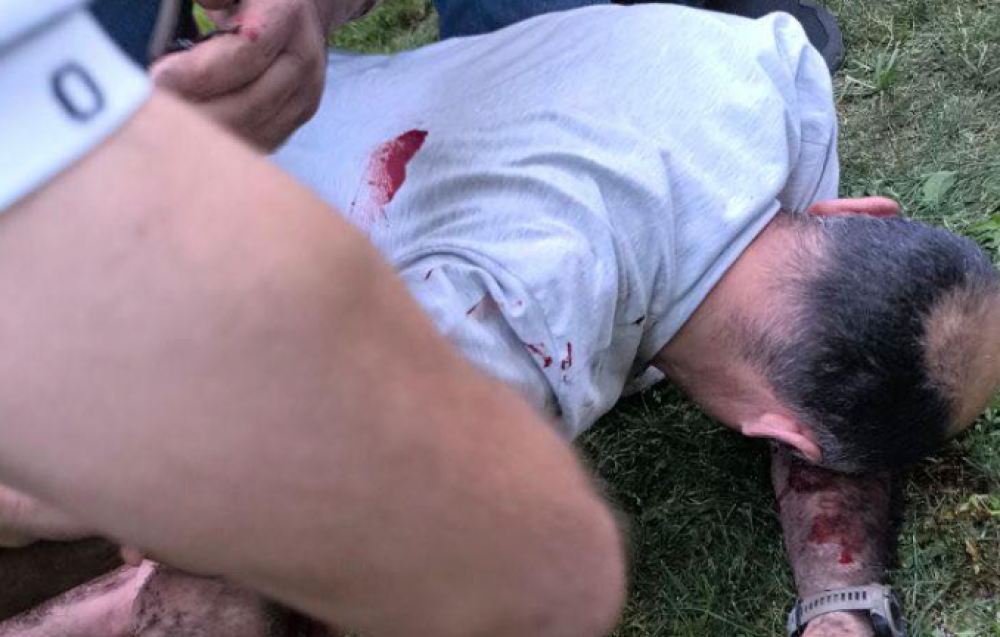 Լուսաձայնային նռնակների կիրառումից հետո քաղաքացիների իրավիճակը լուսանկարներ 18+