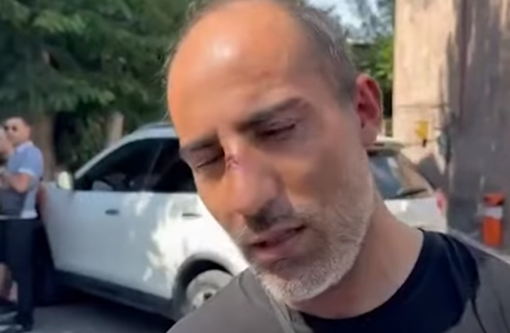 Բերման ենթարկելուց բերետավորը քիթս կոտրել է. ցուցարար (տեսանյութ)