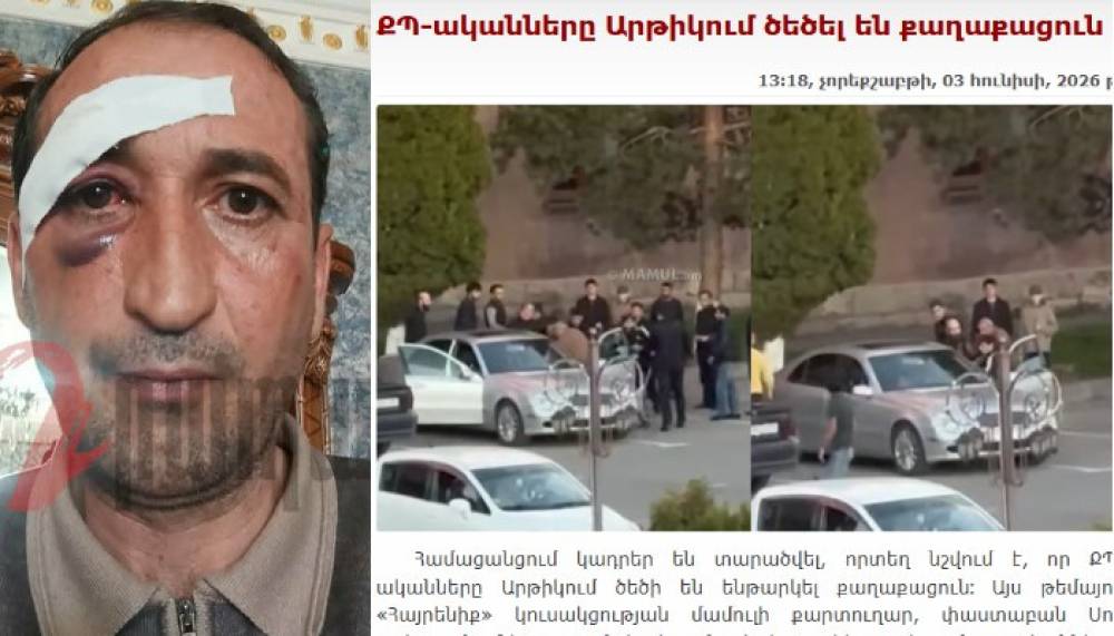«ՔՊ-ի ցուցակով թեկնածուի որդին ասաց՝ կոկորդդ կկ -տրեմ ու խփեց»․ քաղաքացի