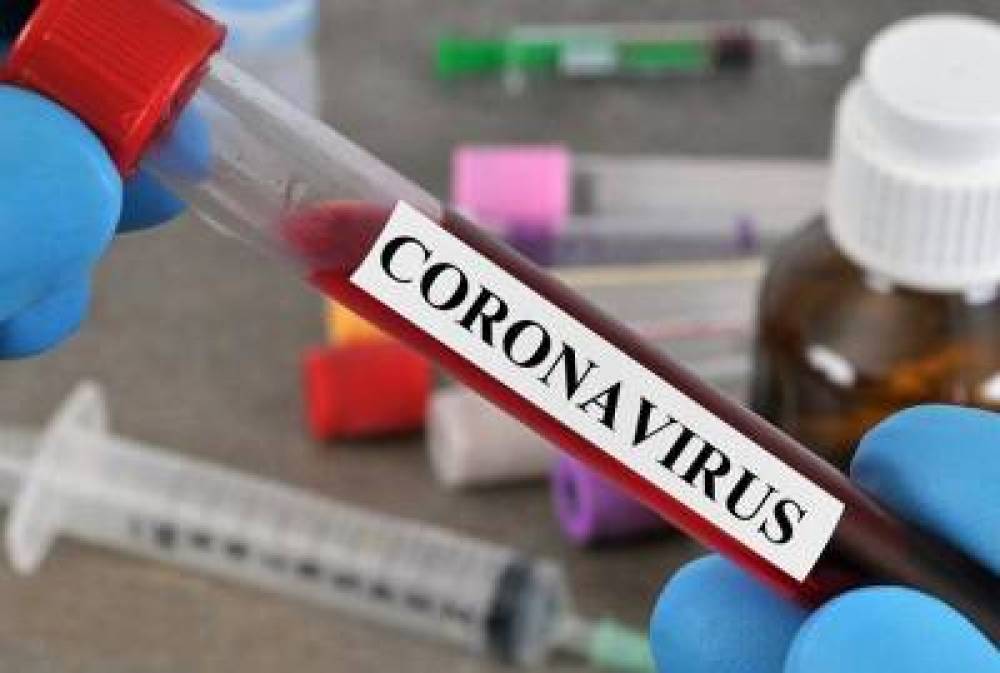 Մեկ օրում՝ կորոնավիրուսով վարակման 251 նոր դեպք. կա 7 մահ.ապաքինվել է 20-ը