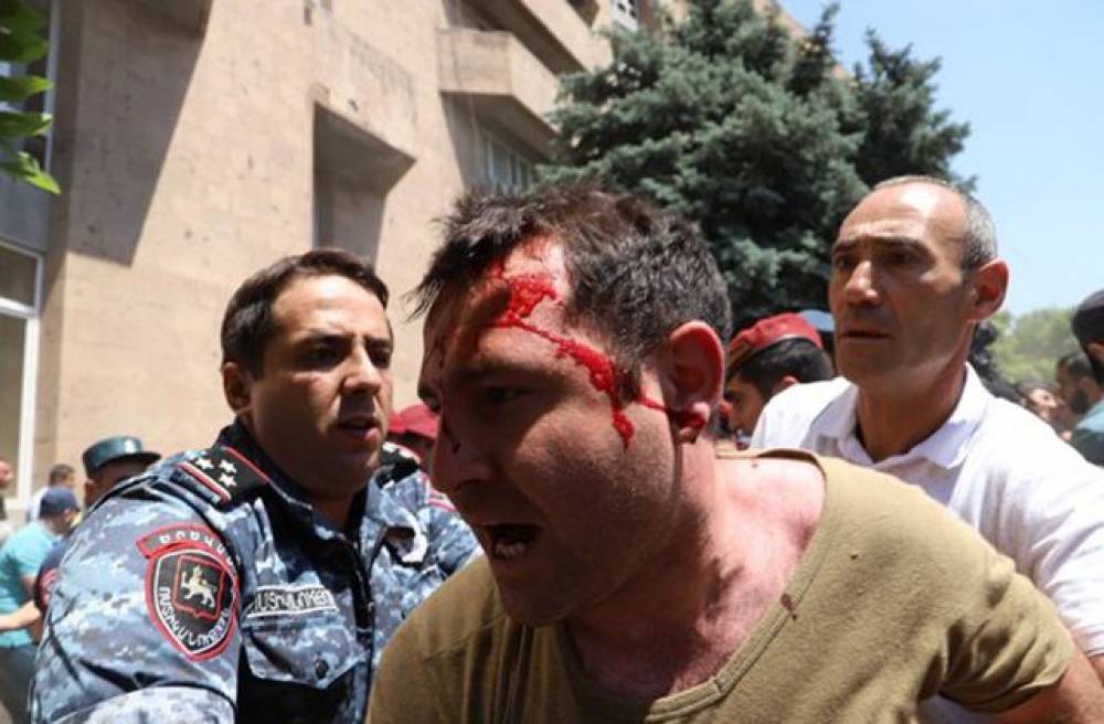 «Ի՞նչ են մտածում այս մասին «ժողովրդավարական, ինքնիշխանական» կեղծ «առաջադեմները»». Ավետիք Իշխանյան