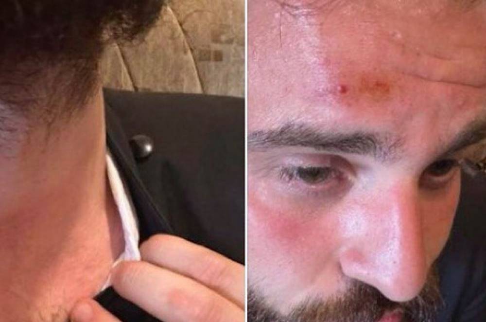 Ծաղրաբար «հայր սուրբ», «հայր սուրբ» ասելով՝ դաժան ծեծի են ենթարկել Դանիել սարկավագին․ Ռուբեն Մելիքյանը մանրամասներ է հայտնում