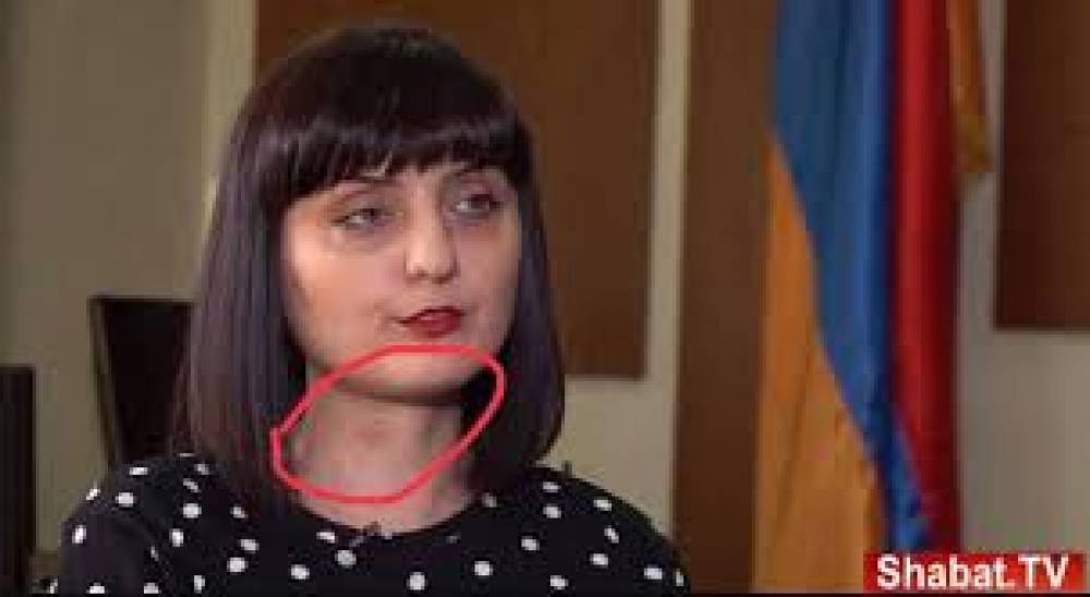 Բաթոյան Զարուհու վտանգավոր ֆանտազիան